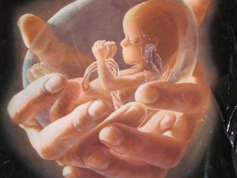 L’aborto divide gli americani come nessun altro argomento 1